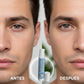 Gel contorno de ojos
